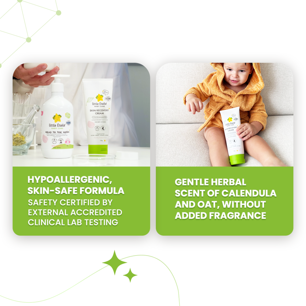 Skin Recovery Cream For Dry & Eczema-Prone Skin (0+ Months)